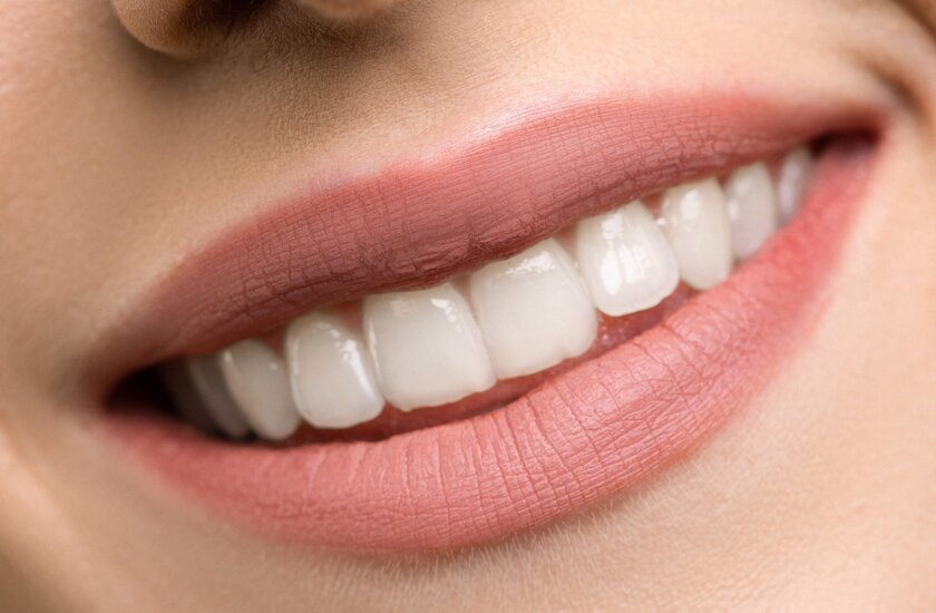 Имплантация зубов – самый современный способ восстановления улыбки